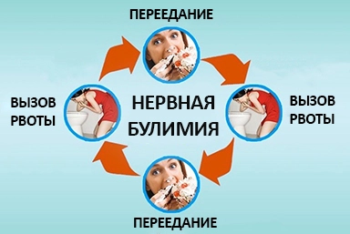 Лечение булимии в Алатыре